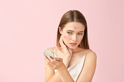Акне и розацеа: в чем отличия? - фото